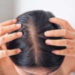 Hair Growth Supplements