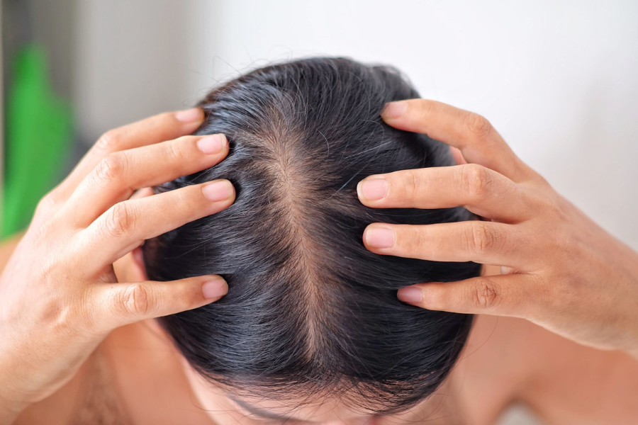 Hair Growth Supplements